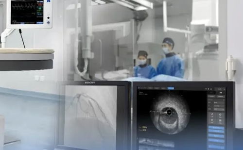 上半年45个创新医疗器械获批，国产超声设备向高端化迈进