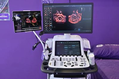 多款“无锡高新区造”亮相 GE医疗创新超声设备引领行业新潮流